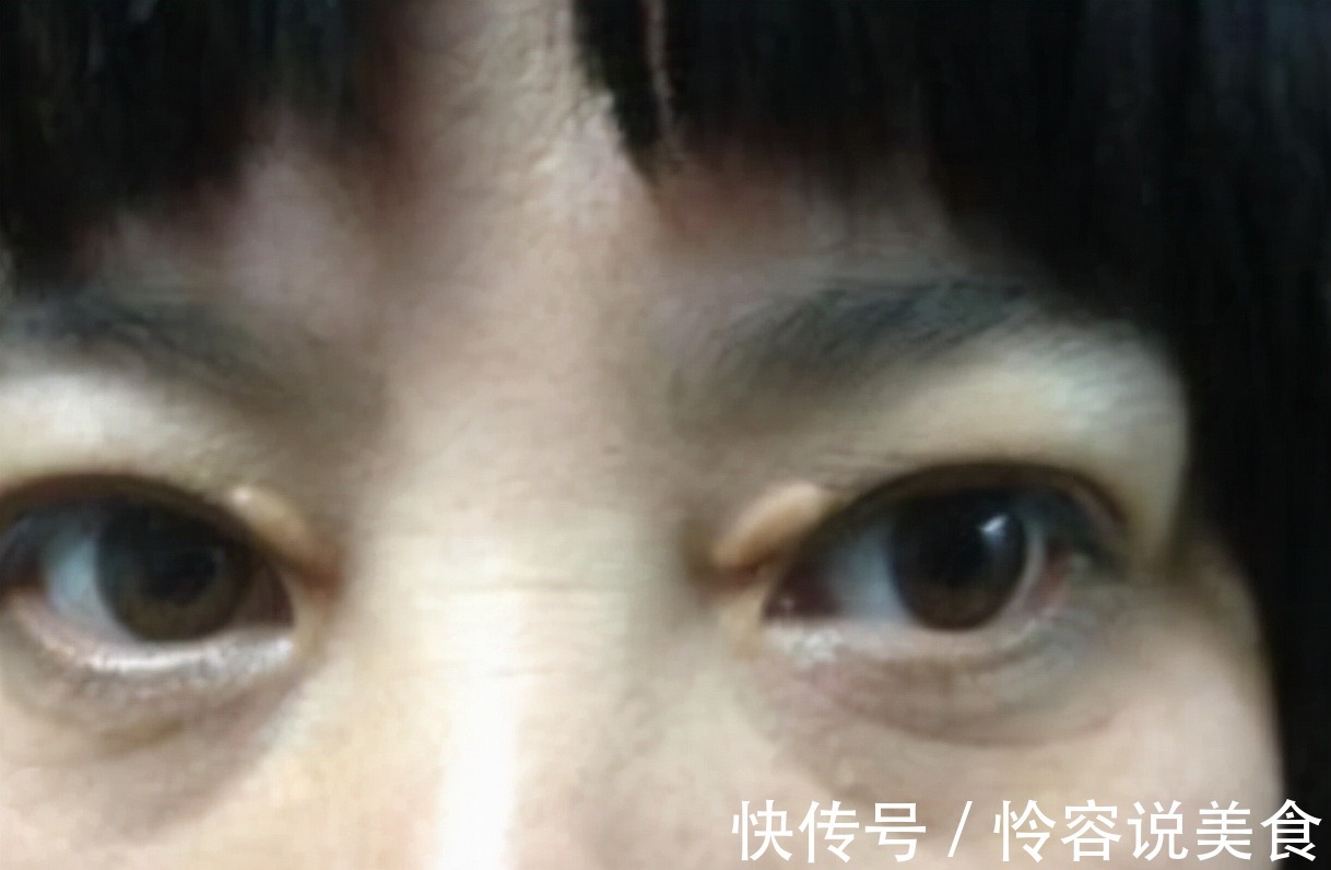 冠状动脉|多走路能降血脂医生提醒日常多吃这4物,或比走路效果好