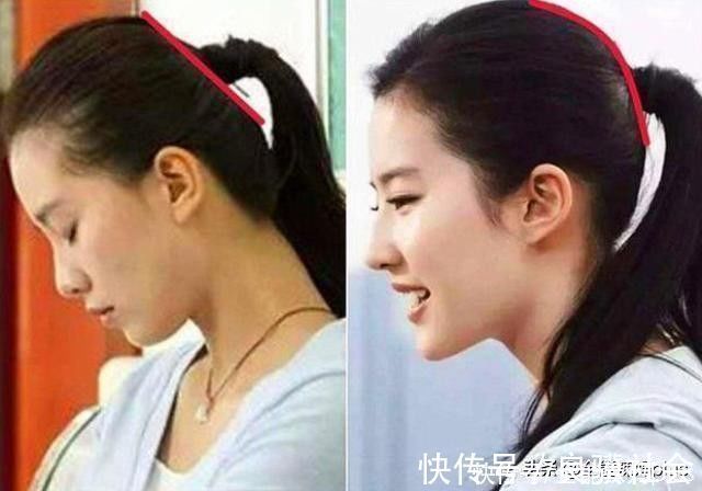 圆头|“妈求求你,别给我睡扁头了”扁头有多毁娃?3张对比图告诉你