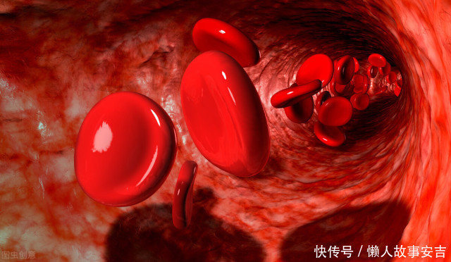 高血脂患者|大鱼大肉并非高血脂的根源，这3物才是！劝你尽早管住嘴，莫贪吃
