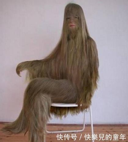 除掉|她是“体毛”最长的女子,曾打破世界纪录,除掉体毛后惊艳了众人