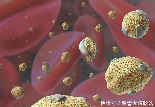 血脂|低密度脂蛋白高,教你一日三餐这样吃,血脂降下来,血管畅通