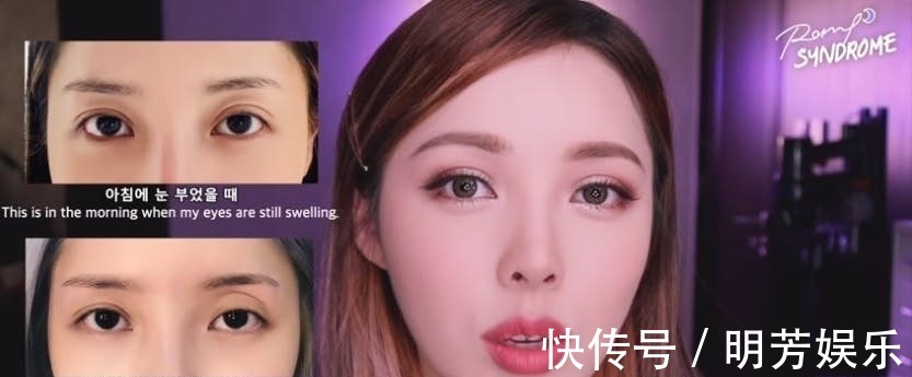 Pony 美妆教主Pony大方坦承整形两次!术后跟粉丝分享“术前VS术后”!