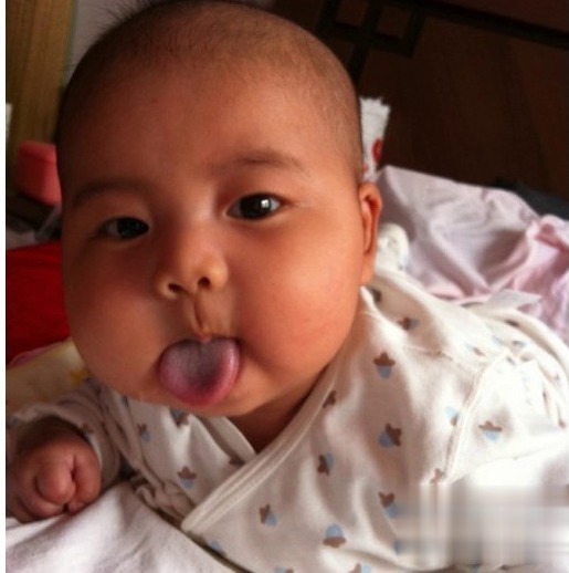 宝宝|如果宝宝脸上有这3种现象,说明宝宝脾胃有问题,别不在意