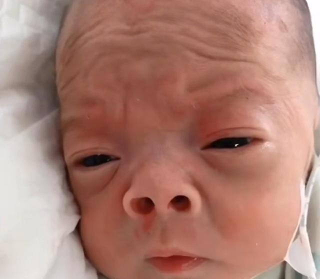 小宝宝|还记得“丑哭宝妈”的网红宝宝吗?当初你嫌我丑,如今美到认不出