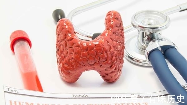 dn找到诱发甲状腺癌的4大因素，做好预防，避免甲状腺癌找上门来