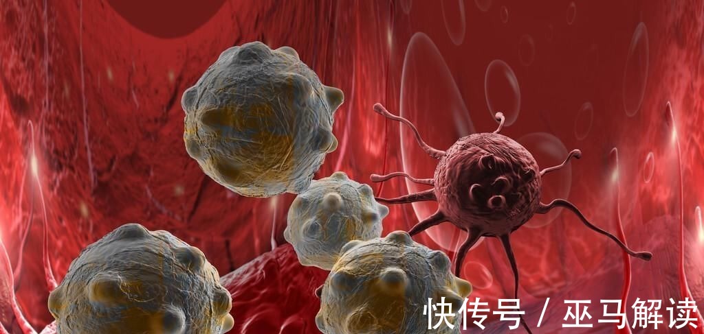 阿姨|50岁阿姨患癌十几年未复发,全靠这3个好习惯,癌症患者受益了