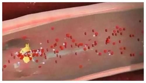 人体|身体上这个位置越软,你就越健康越长寿,不妨自己摸一下!