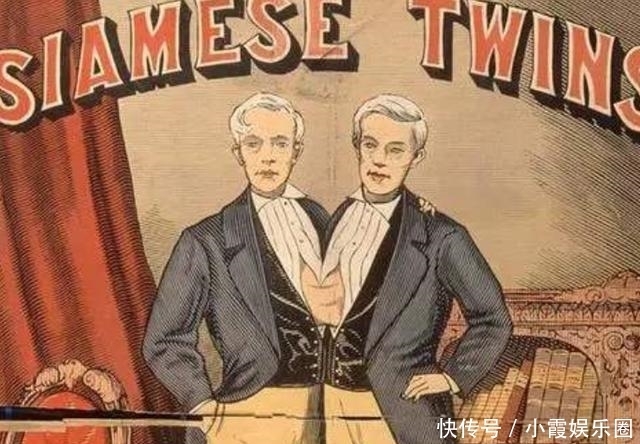 马戏团|泰国连体兄弟,在美国马戏团打拼10年,迎娶两姐妹,生了21个孩子