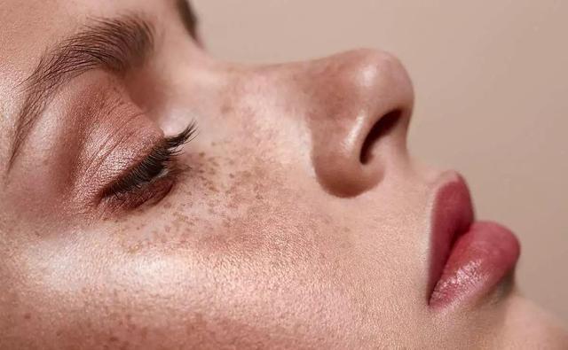 祛斑|黄褐斑还“挑人”？6种女人易长斑，养血祛斑：吃4物，做2事