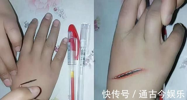 行为|孩子青春期行为有多怪异?在手上画伤口,这种“中二病”行为算吗