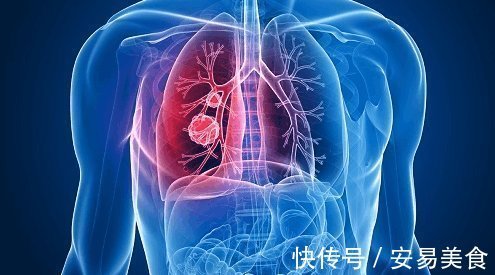 咳嗽|这几种咳嗽可能是肺癌的信号, 还请尽快去医院检查!