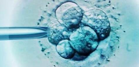 胚胎|【孕育新生】“试管婴儿”在胚胎实验室里的变化