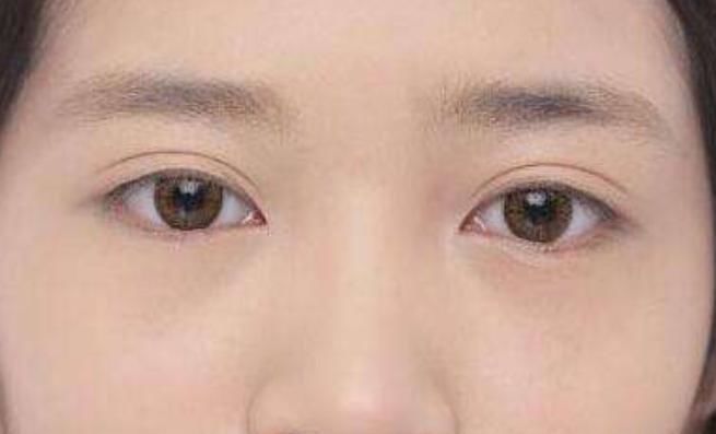 长寿|寿命长短,外貌会“显露”,长寿老人基本都有,赶紧看看你满足吗