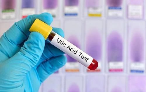 嘌呤|一旦查出尿酸高，这6种食物，尽早列入黑名单，有你爱吃的吗？