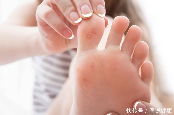 患者|糖尿病靠近,睡觉时常常有4个标志,若你有,提示你该控糖了!