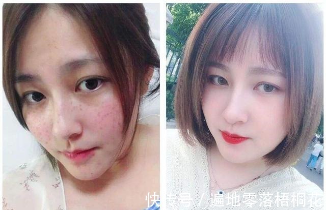 维生素E|红霉素软膏+维生素E，美白淡斑有奇效，解决了很多色斑女人的烦恼！