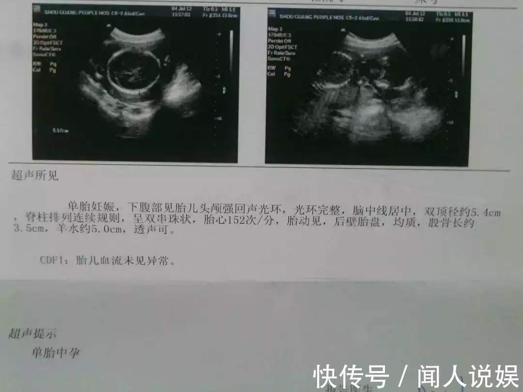 b超|刚怀孕,第一次孕检别盲目,只要这3项指标正常,胎儿就是健康的
