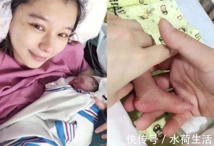 剖腹产|为何女明星宁愿在肚子“挨一刀”,也不愿顺产生娃?情有可原