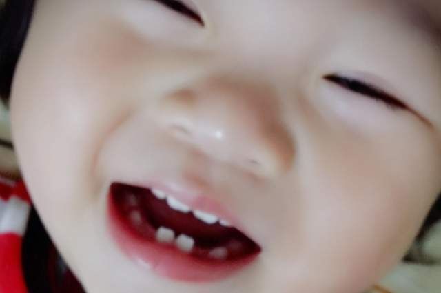 医生|宝宝一出生就有两颗牙齿,宝妈满心欢喜,医生却泼冷水:拔掉吧