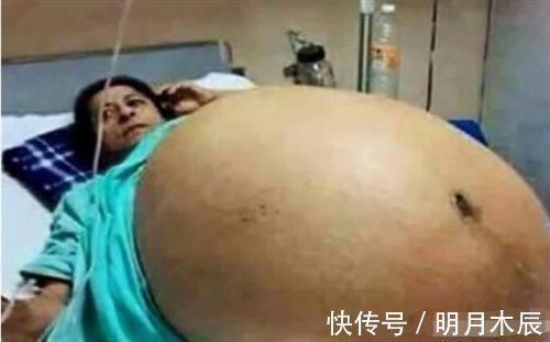 足球队|孕妇的肚子大如“牛”,一个肚子生下了一个足球队!