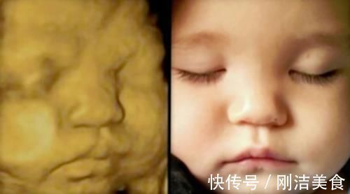 孕妈|孕妈看到胎宝“四维照”,表示娃不像自己,准爸爸:他也不像我!