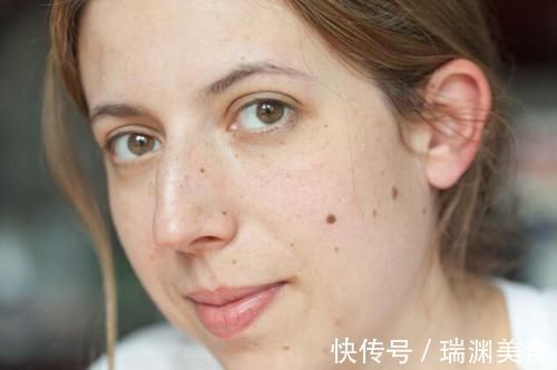 皮脂腺|长期失眠,身体通常会出现5种变化,若你有,需及时改善失眠