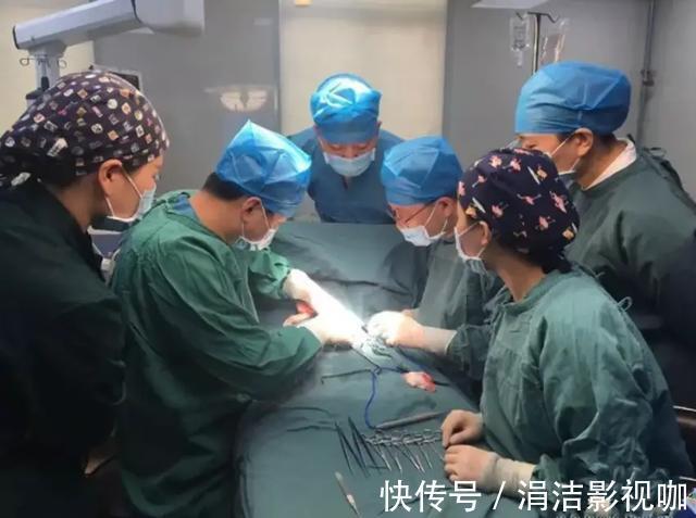 寄生胎|男婴一出生肚子圆如鼓，7天后剖腹，“生”下一个四肢完整胎儿