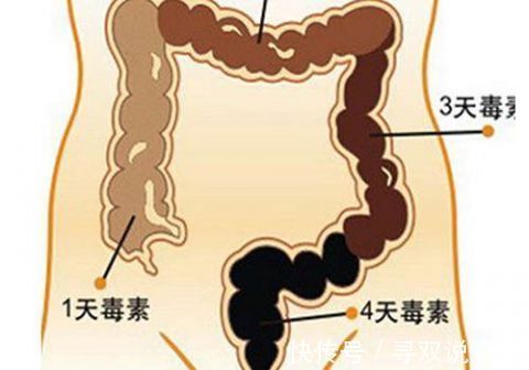心火旺|排宿便、肠道排毒、洗肠养生...都是伪科学!