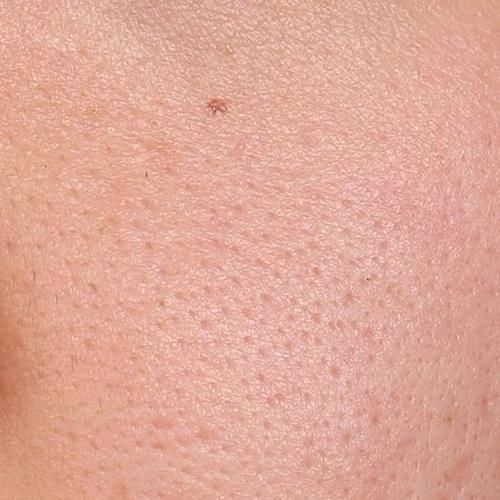 缩毛孔效果不大？对抗毛孔问题还是得来点硬的