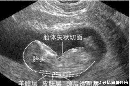 b超|孕期产检不想生个“傻孩子”，这三项产检必须按时做，不能忽视