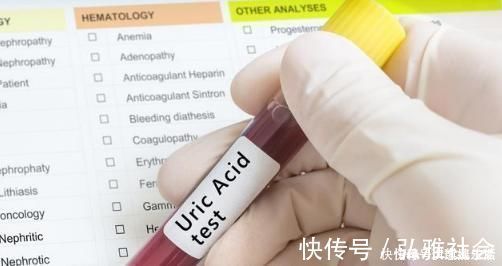 痛风|高尿酸导致痛风苦不堪言，医生：做到这2点，让你尿酸嗖嗖降