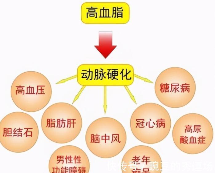 血脂升高|盘点高血脂八大认识误区,专家教你正确认识高血脂,建议收藏