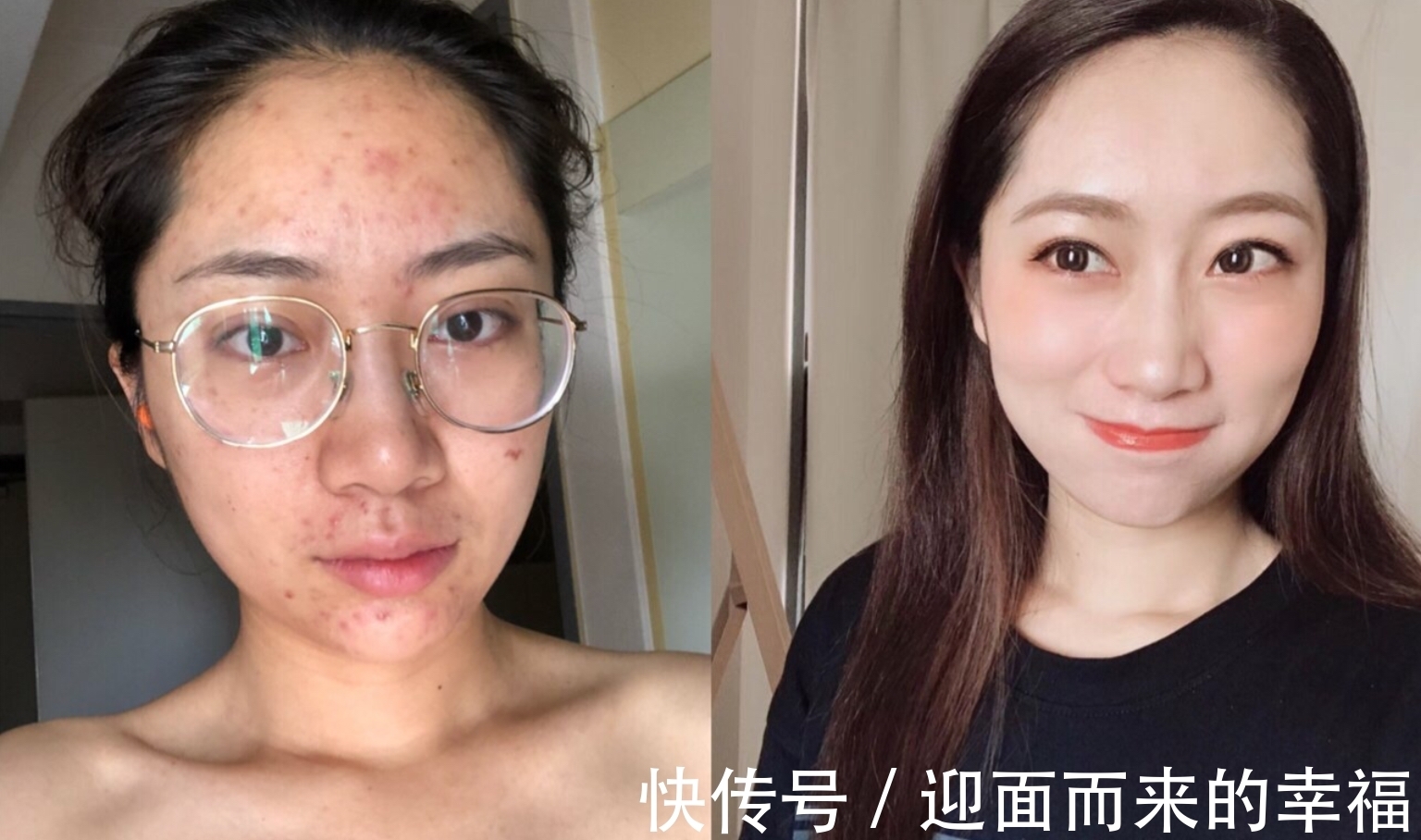 皮肤 护肤“谣言”的13个坑,你是不是全中?