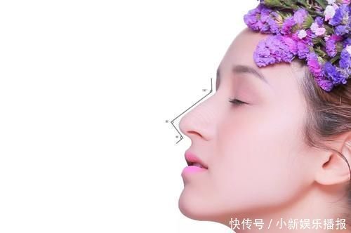 鼻部|隆鼻假体会露吗？鼻梁会塌吗？会留疤吗？注射安全吗？能戴眼镜吗……