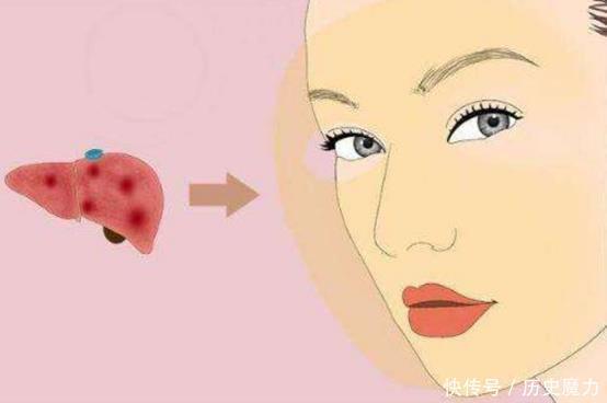 么有可能|肝病科主任肝病来临,身体有3个异常,若没有,那恭喜你