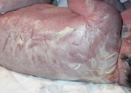 出生|宝宝出生全身裹满“奶油”,爸爸见状被“急哭”,医生看后却笑出了声