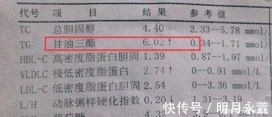 甘油三酯高|甘油三酯偏高，3种食物需“忌口”，若你爱吃，血管或加速变堵
