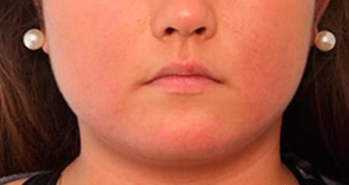 你周围大脸的女生多吗？拥有一张大脸是种怎样的感受？