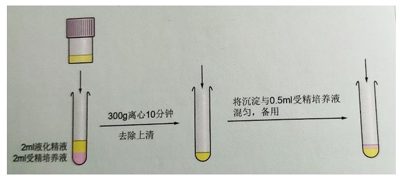 精子|【孕育新生】常用精液处理方法简介