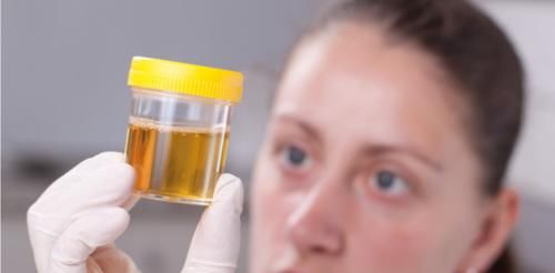 肾病|看尿量就能知道肾功能的好坏？教你“2招”防范尿毒症更有效