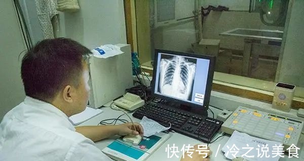 肺癌|夫妻俩先后查出肺癌,医生手部早就给出提醒,却没及时发觉