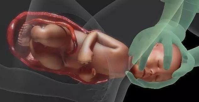 宝宝|孕晚期,避免胎儿脐带绕颈?你需要注意这些