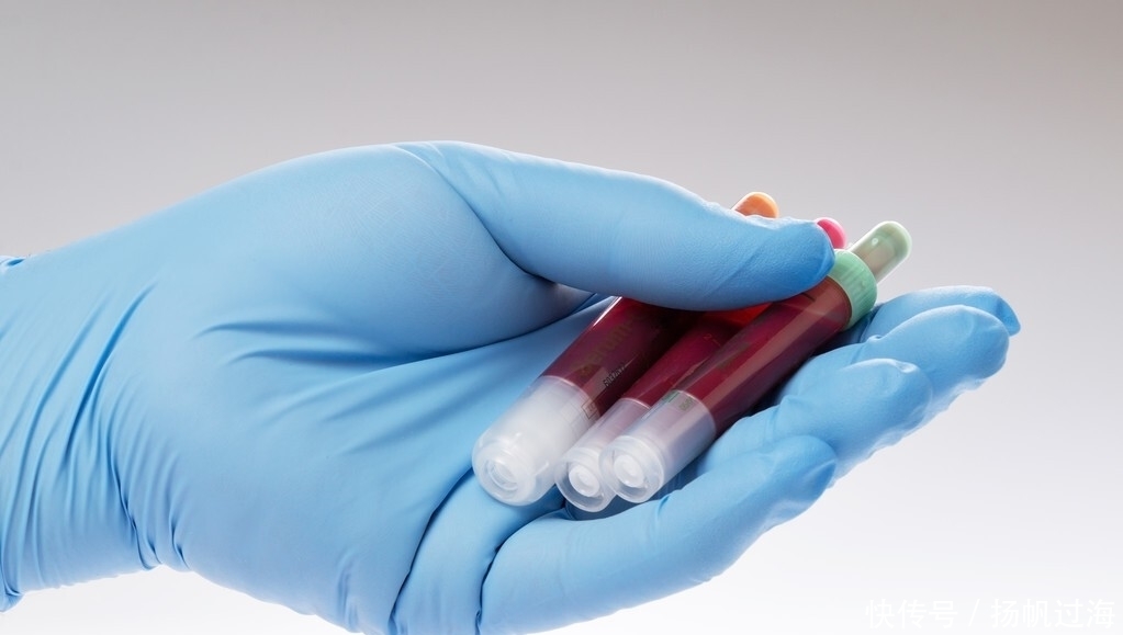 心血管主任:补充1种“酸”,血管干干净净、血脂能降下来