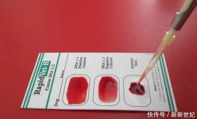 我国哪种血型的人最多血型和长寿、性格