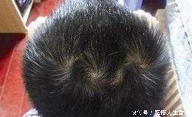 头旋|孩子头上的“旋”的个数,暗示孩子智商高低家长要了解真相