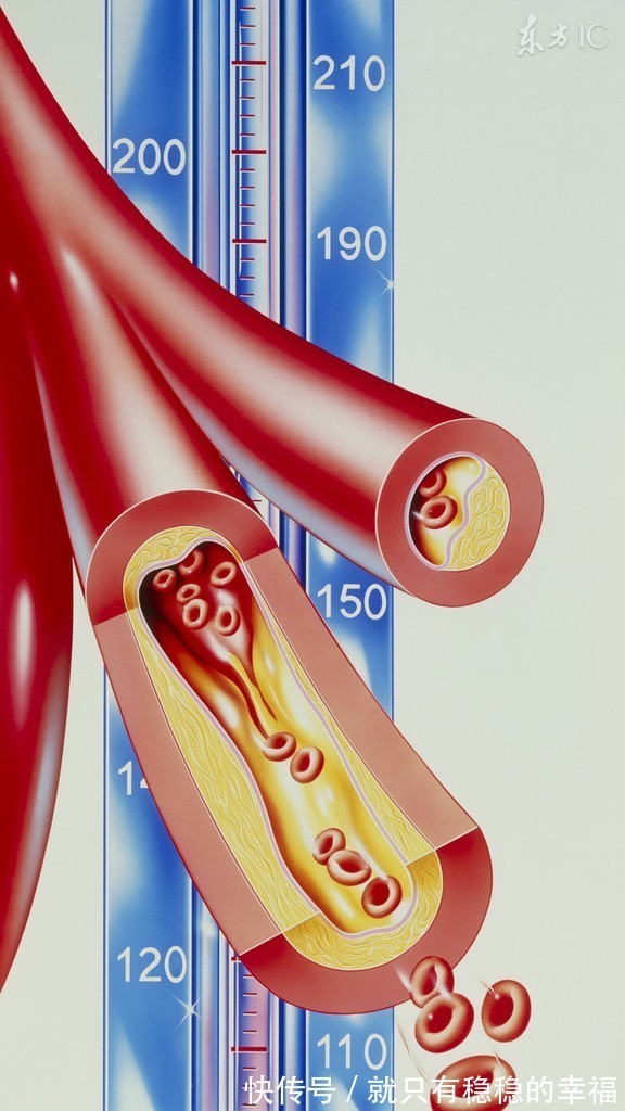 血压|高血压能不能喝蜂蜜呢今天告诉你,好多人被误导了