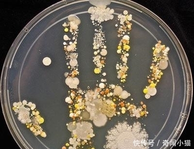菌落|8岁小孩出去玩,回家不洗手按了个手印,妈妈培养48小时后