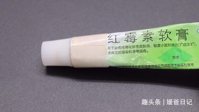 黄凡士林|红霉素软膏的5个作用,简单实用,回家找找有没有,试试