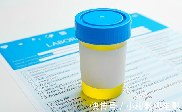 病程|尿酸值同是500，为何有人痛风频发，有人却不疼不痒？医生4点分析