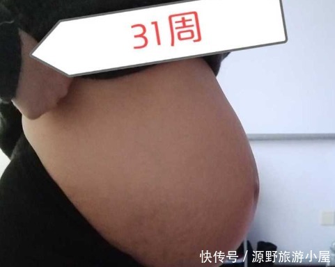 hcg|“hcg都翻倍，咋又胎停育了”早孕胎停育有哪些原因